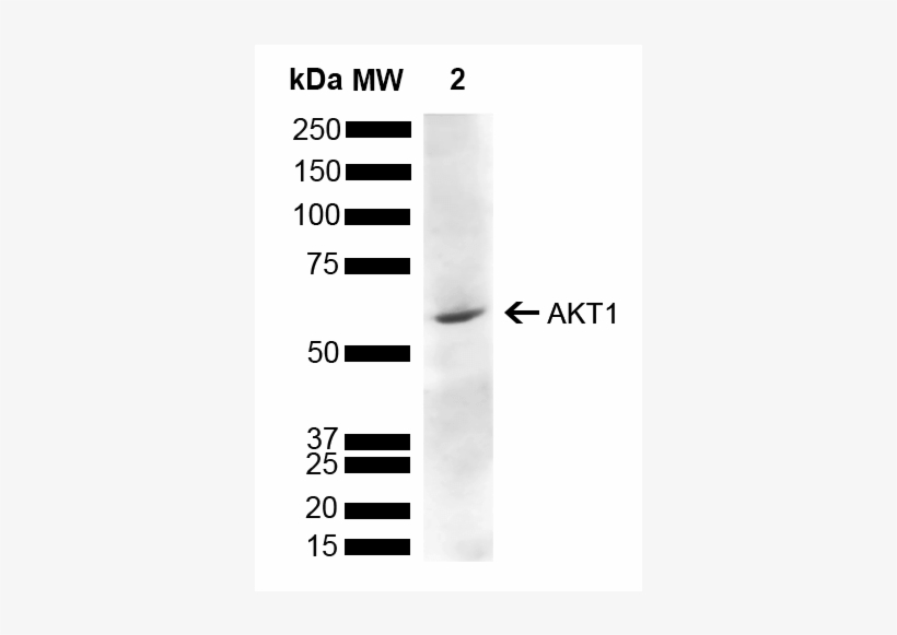 Spc-789 Akt1 Antibody Wb Rat Liver 1 - Antibody, transparent png download
