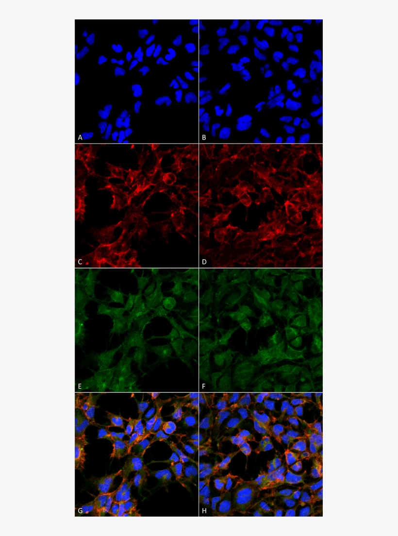 Smc 514 Malondialdehyde Antibody 6h6 Icc If Human Embryonic - Malondialdehyde 1f83 Immunofluorescence, transparent png download
