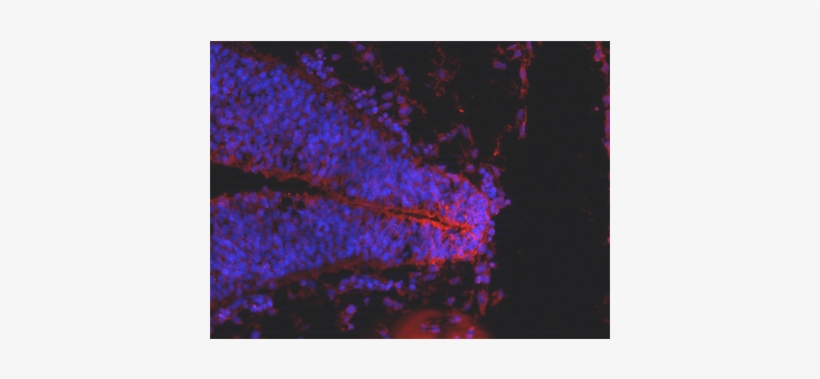 Anti-gpr177 Antibody - Antibody, transparent png download
