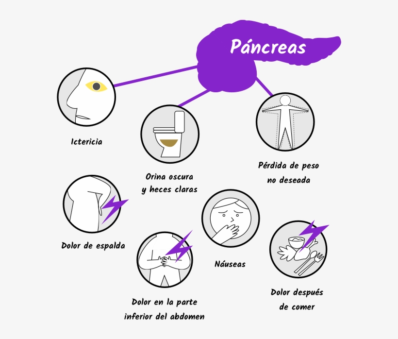 Full - Dolor De Pancreas, transparent png download