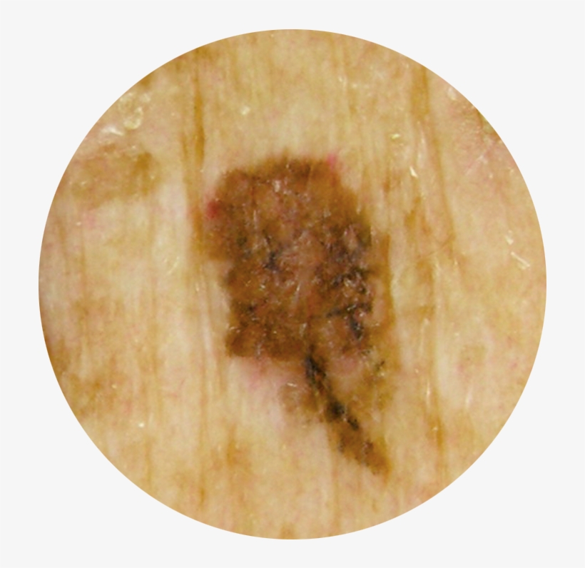 Mel Abcde B - Portable Network Graphics, transparent png download