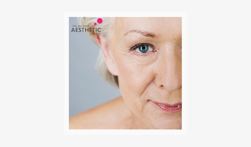 Fine Lines And Wrinkles - Biodroga Md Anti-aging Care For Impure Skin 40 Ml (75gr)., transparent png download