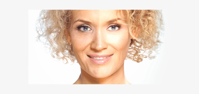 Get Rid Of Wrinkles - Brazilian Plastic Surgery, transparent png download