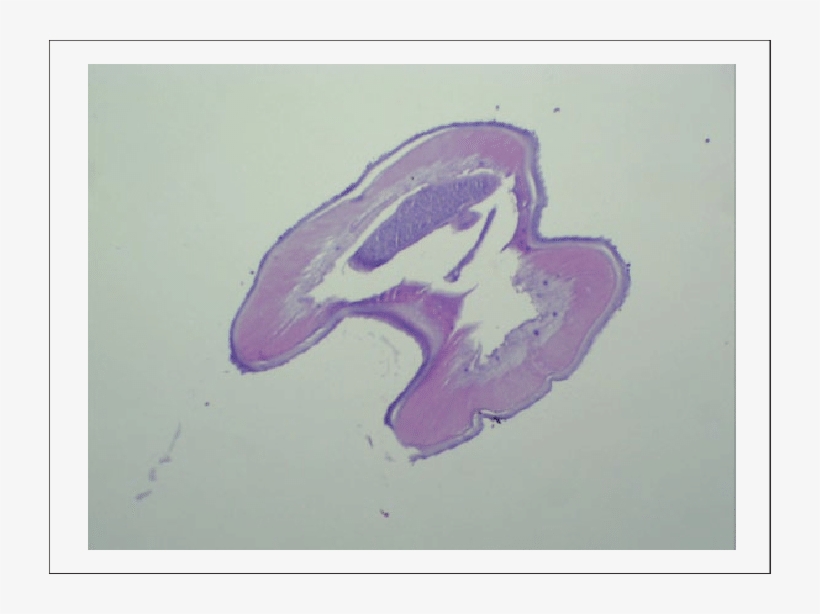 Transverse Section Of D - Muscle, transparent png download