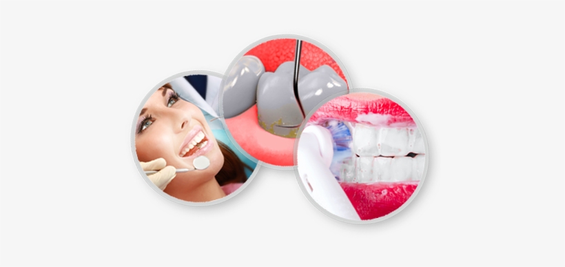 Dental Cleaning Jumeirah Dubai - Dental Cleaning Png, transparent png download