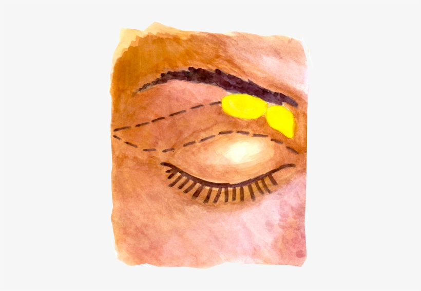 Viksraitis, Viksraitis - Sv Plastinės Chirurgijos Centras, transparent png download