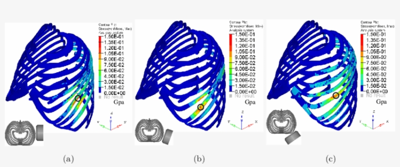 Stress Distribution Of Ribcage In Impacts At Three - Diagram, transparent png download