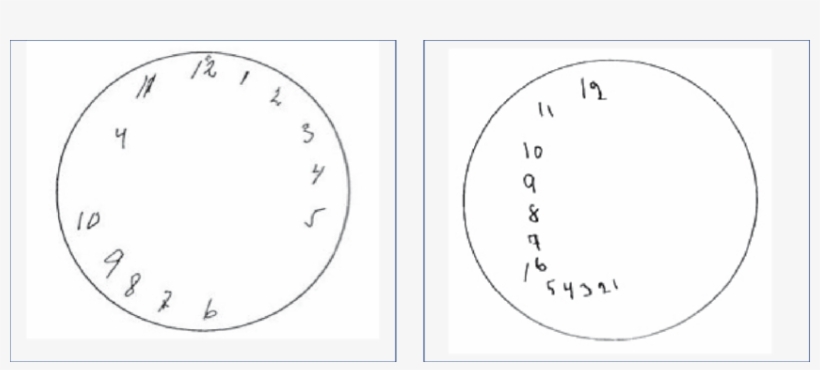Resultado Del Dibujo De La Prueba Del Reloj - Figura De Un Reloj Png, transparent png download
