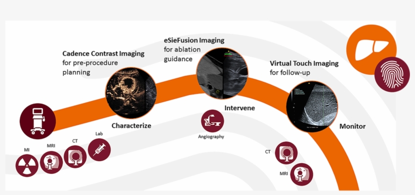 Personalized Liver Ultrasound - Circle, transparent png download