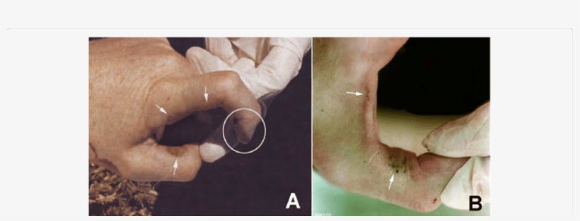 Gunshot Soot On The Left Hand Of The Colonel - Soot, transparent png download