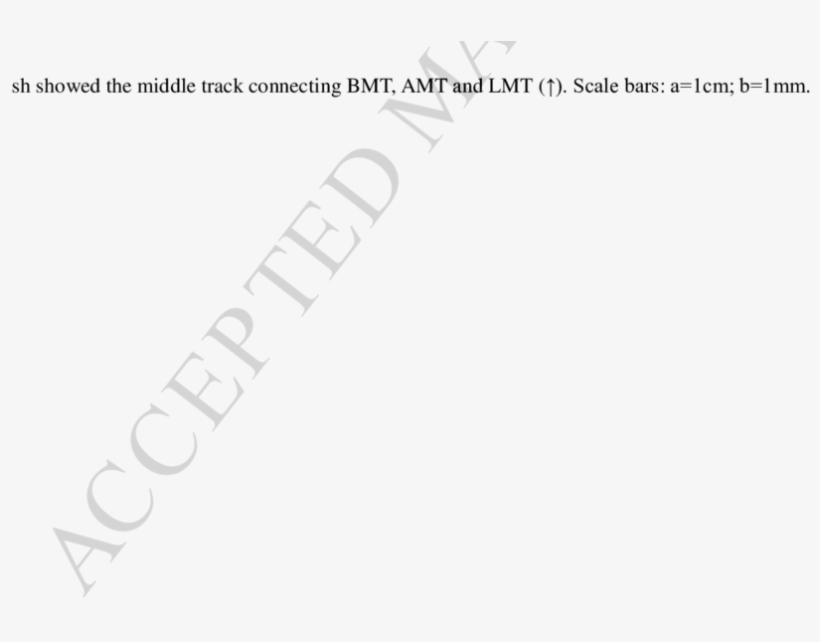 A) The Middle Track Surrounding Vertebral Column (↑) - Tissue, transparent png download