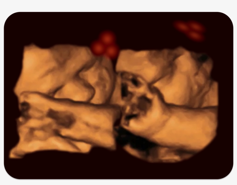 4d Fetus - Καλο Μηνα Μωρο, transparent png download
