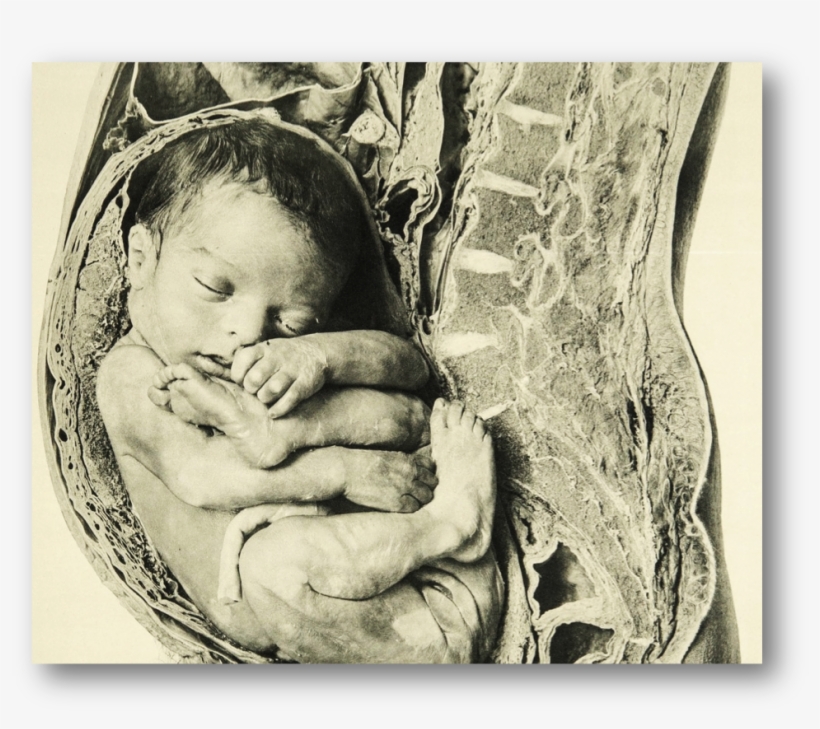 Detail, Near Full Term Fetus Placed With Anatomical - Anatomy, transparent png download