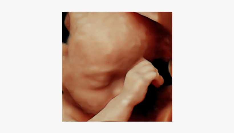 Reveal Hidden Details And Enrich Clinician-patient - Baby, transparent png download