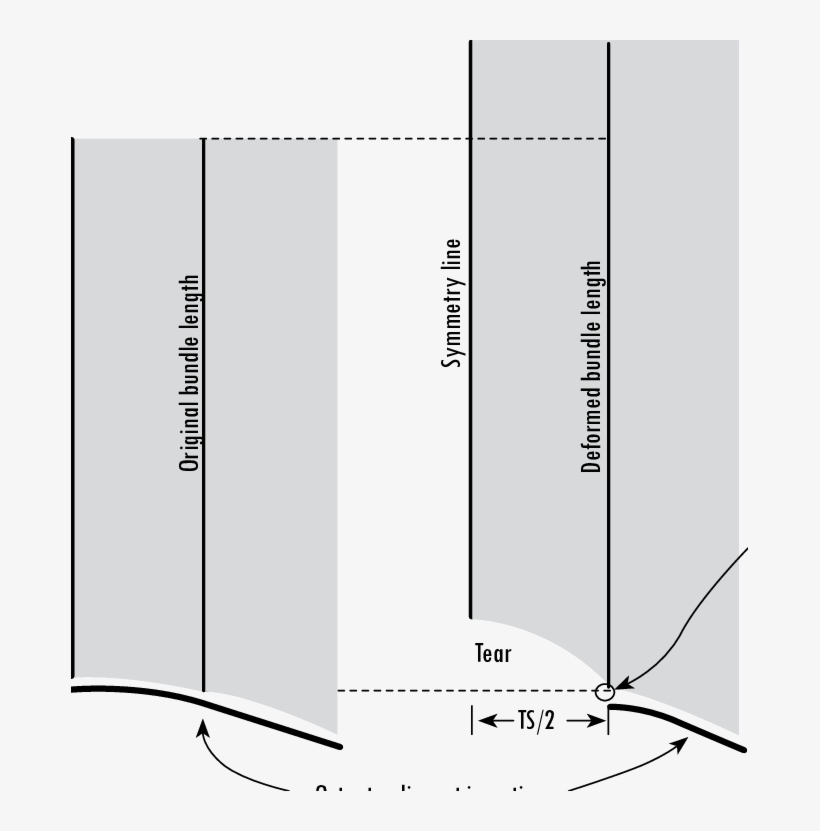 Failure Of The Tear Edge Fiber Bundle At Tendon Ultimate - Tendon, transparent png download