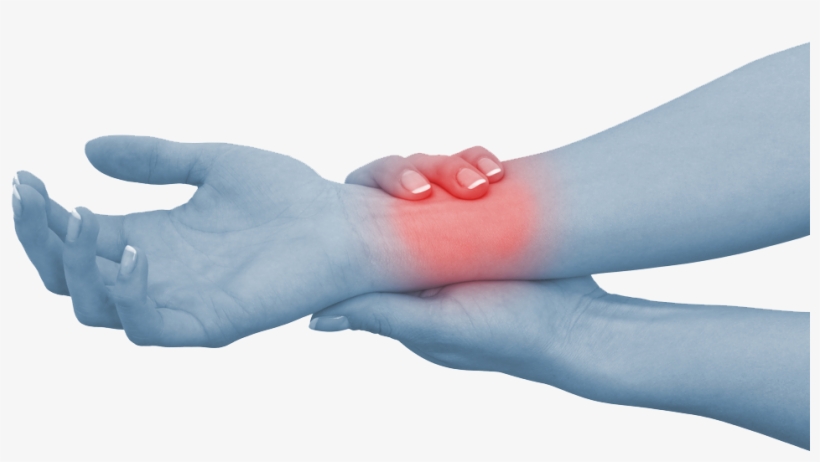 Carpal Tunnel Syndrome Causes, Symptoms, & Treatment - Carpal Tunnel Syndrome, transparent png download