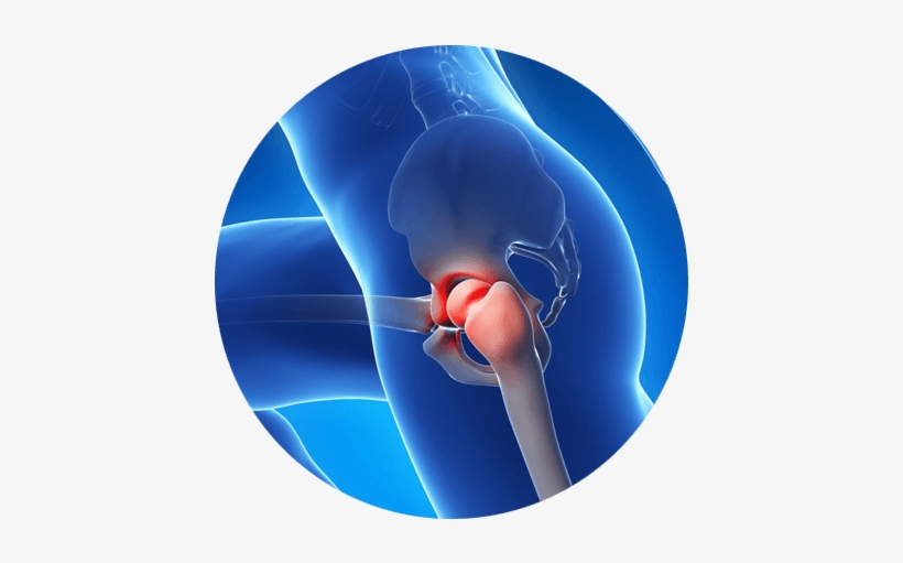 Relieve Hip Pain Without Surgery - Hip Pain Png, transparent png download