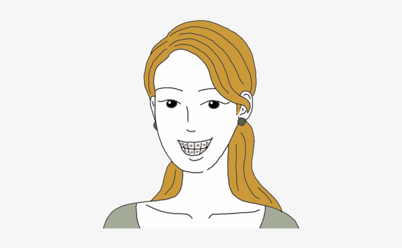 Teeth Or Tooth Dreams - Dental Braces, transparent png download