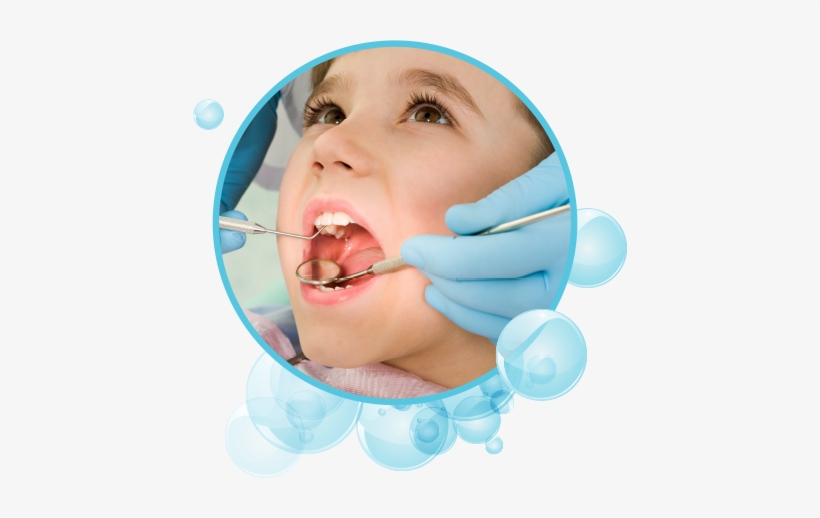 Routine And Diagnostic Care - Що Таке Карієс, transparent png download