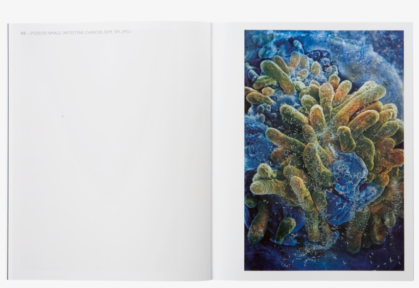 Damien Hirst Beyond Belief Catalogue - Small Intestine, Sem - Rectangle Magnet, transparent png download