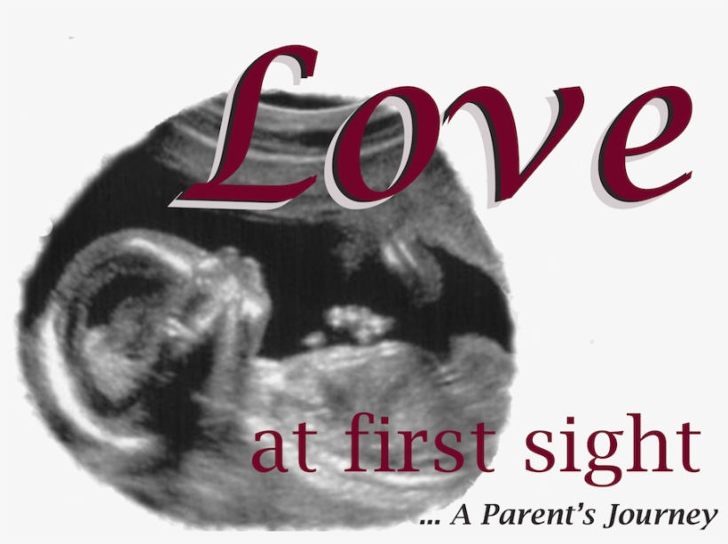 Thank You To Those Who Have Donated In Loving Memory - Baby Sonogram 2 Sided Necklace, Ultrasound Necklace,, transparent png download