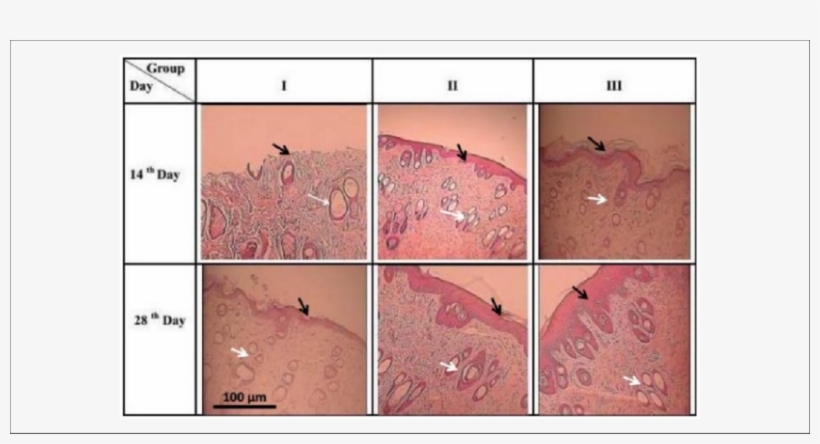Skin Photomicrographs Of Second-degree Burns Treated - Aloe Vera, transparent png download