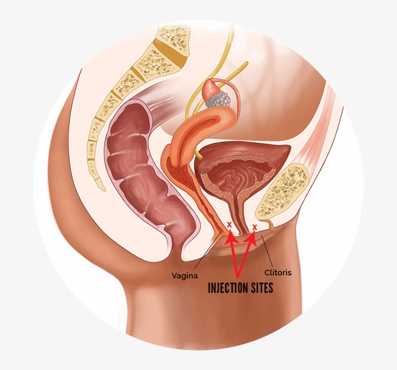 Lady Spot Shot Diagrahm, transparent png download