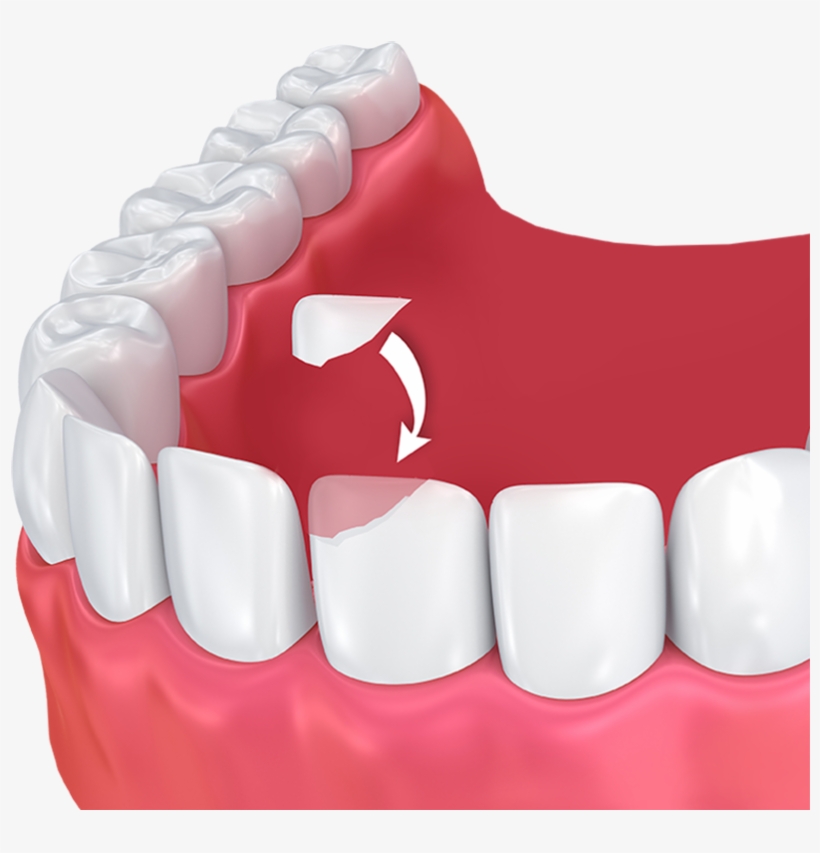 Human Tooth, transparent png download