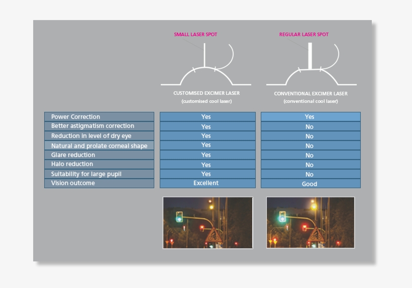 People Have Reported Of Longer Dry Eyes Because Of Lasik Eye Surgery Cost Malaysia Transparent Png 688x494 Free Download On Nicepng