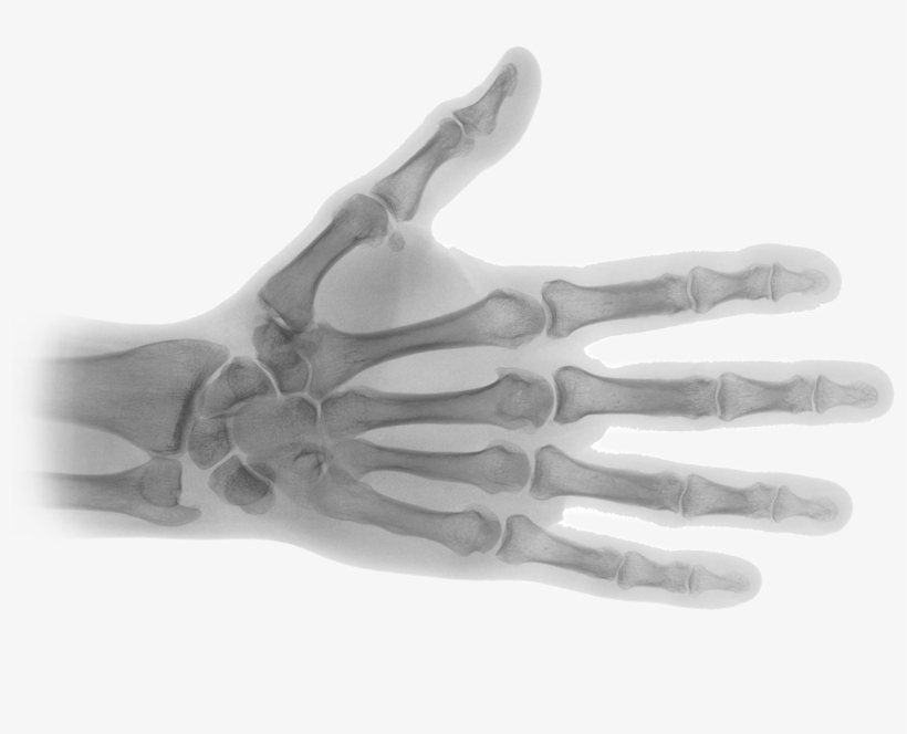 X Ray Transparent Png, transparent png download