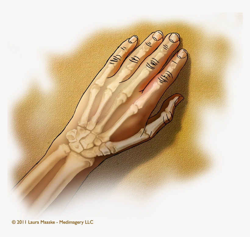 Medical Illustrations Laura Maaske Medical Illustrator - Ligament, transparent png download