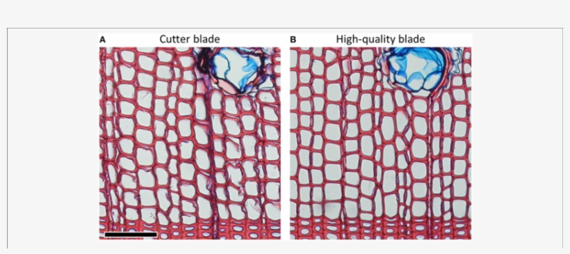 Pinus Sylvestris Cross Sections Of 15 Μm Thicknesses - Scots Pine, transparent png download