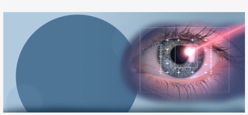 Findlay Optometry Clinic Inc-logo An Eye And Laser - Call It Pay-back [book], transparent png download