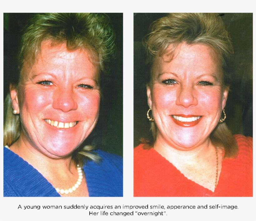 A Young Woman Suddenly Acquieres A New Smile - Woman, transparent png download