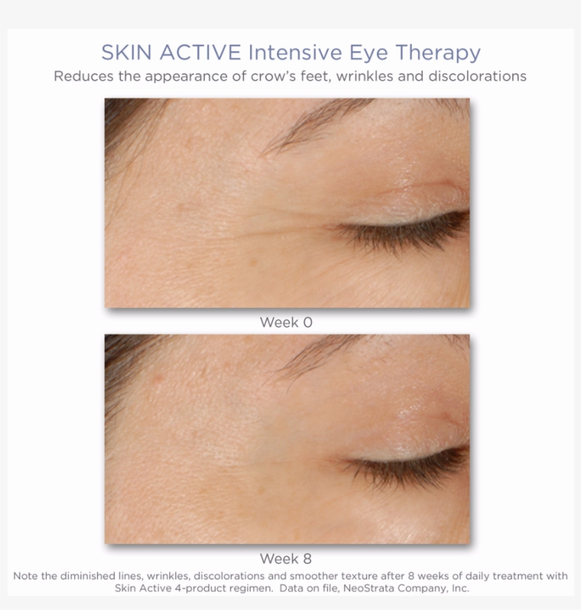 Neostrata Skin Active Intensive Eye Therapy - Neostrata Skin Active Eye Therapy, transparent png download