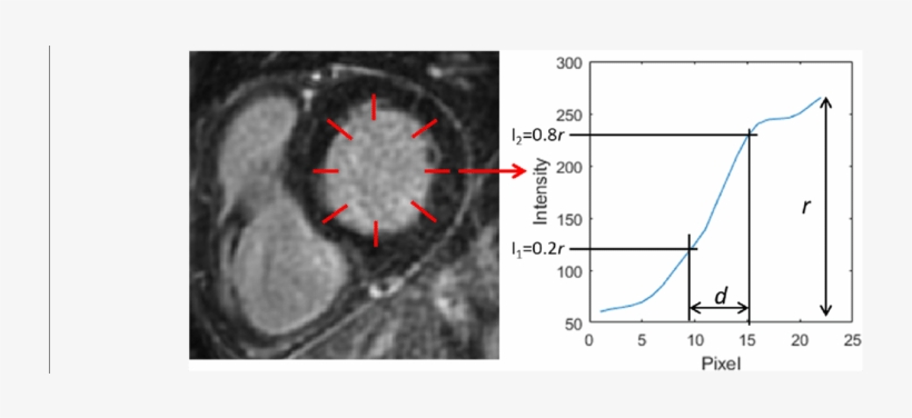 Example Of Endocardial Border Sharpness Analysis In - Diagram, transparent png download
