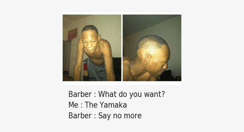 Barber What Do You Want Me The Yamaka Barber Say No - Worst Hairline In The Words, transparent png download