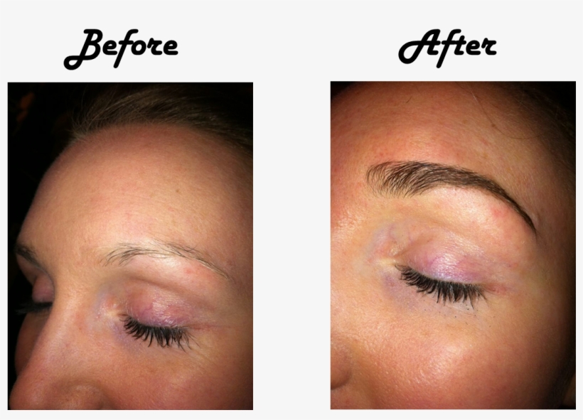 Eyebrow - Prp Treatment For Eyebrows, transparent png download