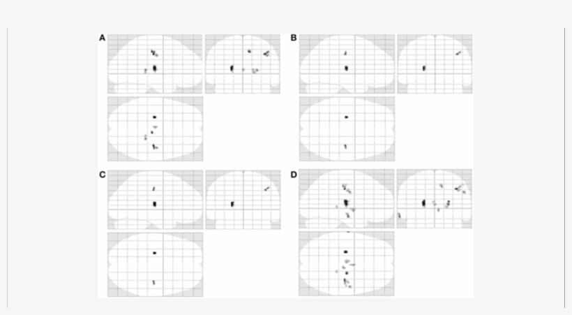 Texture Differences In Als Are Presented In A Glass - Variance, transparent png download