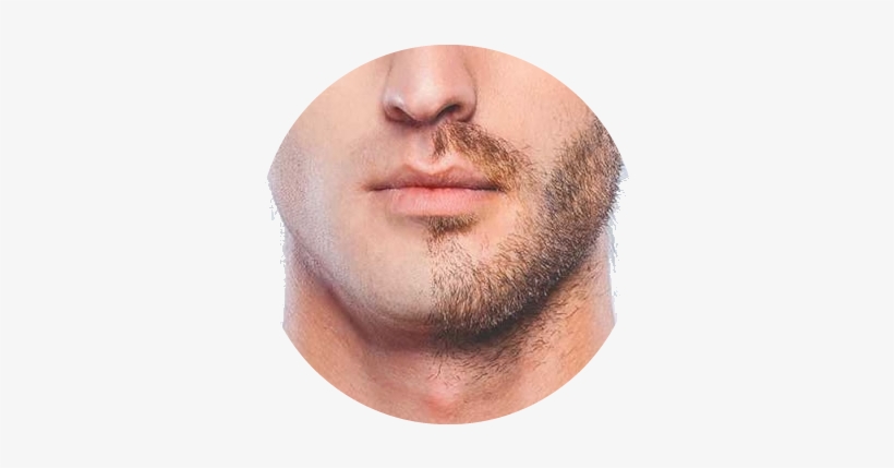 Beard And Mustache Transplantation - Outad Professional Men Liquid Beard Growth Pen Beard, transparent png download