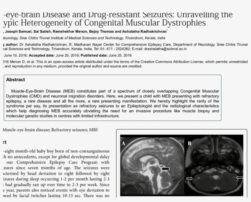 A) Mri Sagittal T2 Images Showing Pontine Hypoplasia - Document, transparent png download