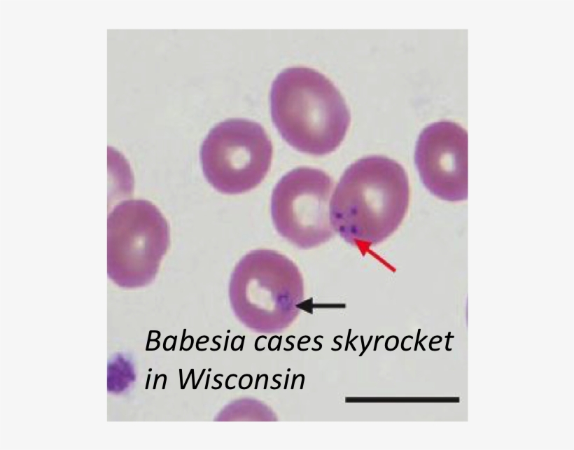The Rising Prevalence Of Co Infections In Rodents May - Babesia Peripheral Blood Smear, transparent png download