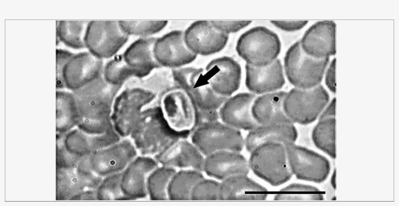 Gametocyte In Peripheral Blood Smear From The Hoary - Hoary Fox, transparent png download