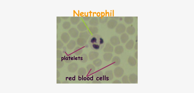 Wbc Differential Blood Report - .edu, transparent png download
