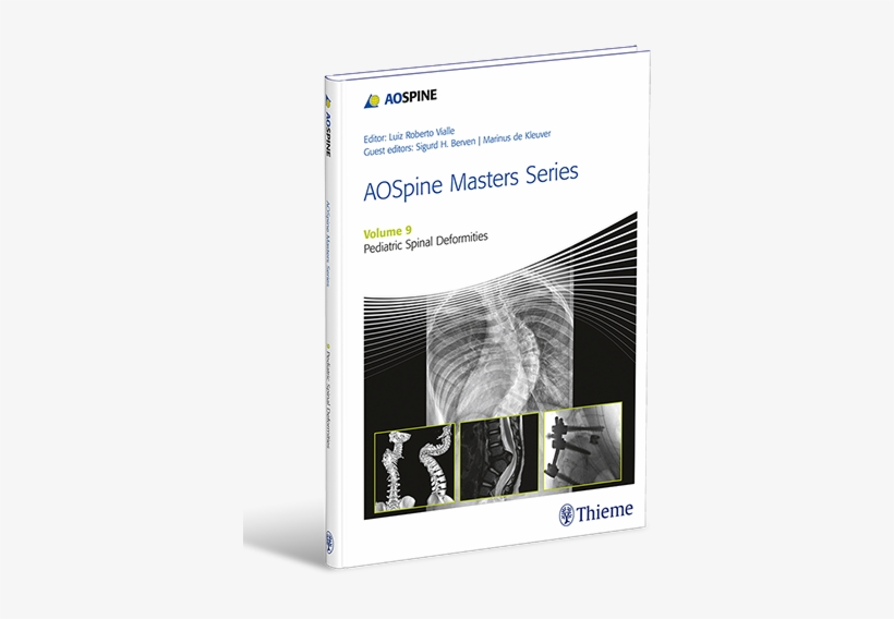 An Estimated 9 Million Children Every Year Are Affected - Aospine Masters Series, Volume 9: Pediatric Spinal, transparent png download