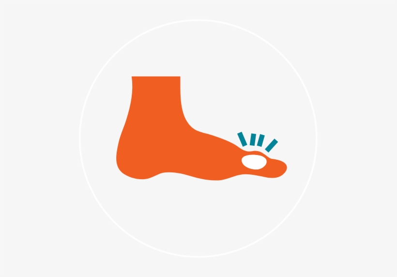 Gout And Chronic Kidney Disease - Gout Png, transparent png download