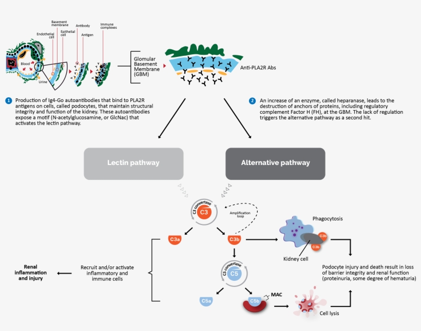 Recruiting Patients With Glomerular Disease For A Phase - Diagram, transparent png download