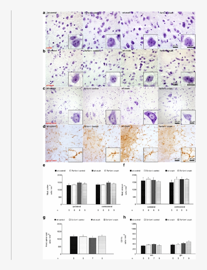 Tor1a / Mice Do Not Present Morphological Changes In - Spinal Cord, transparent png download