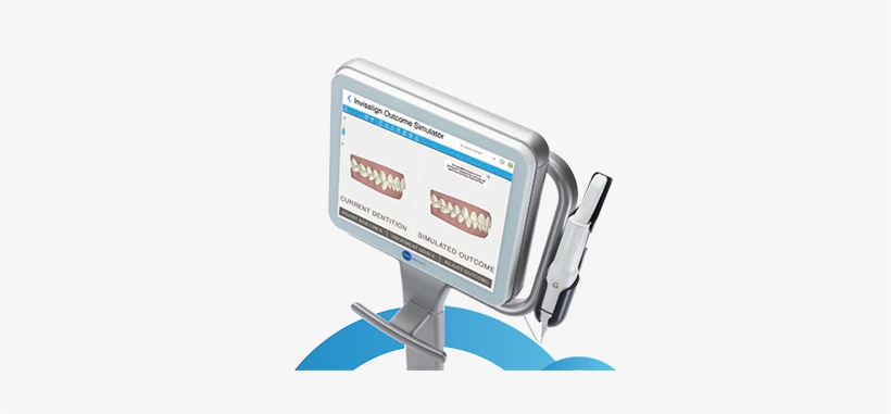Start Smiling With Our Itero® Element™ Scanner - Itero Digital Scanner, transparent png download