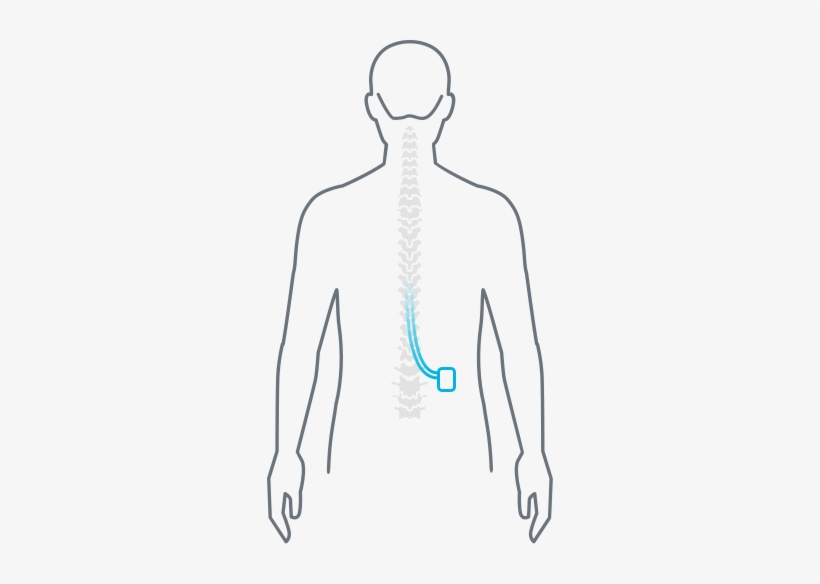 Human Diagram Nevro - Spinal Cord, transparent png download